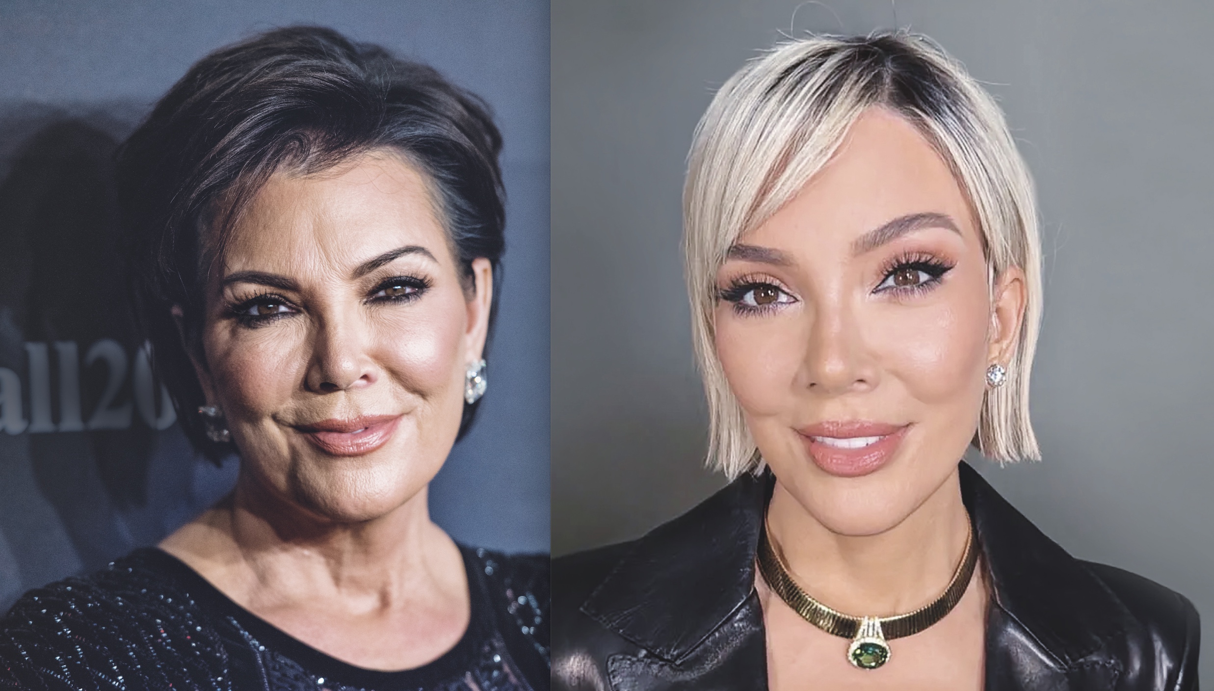 ¿Qué es el Deep Plane? La cirugía que todos quieren... pero sólo se pueden pagar las Kardashian